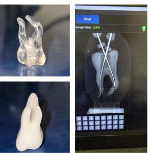 foto-skladne-endo-igorya-noyenka-pro-majsterklas